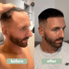 Rosemary Hair Growth Serum
