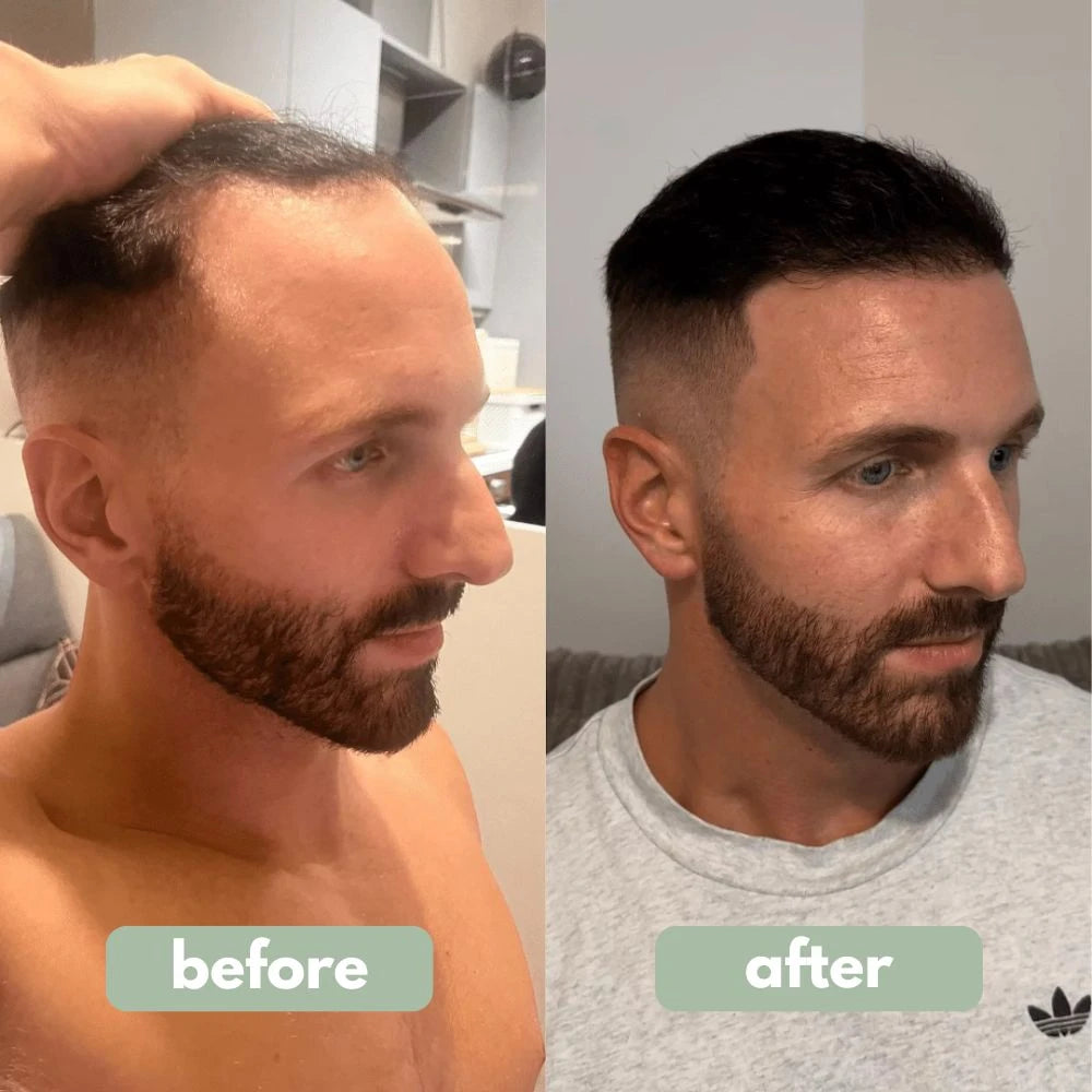 Rosemary Hair Growth Serum
