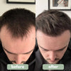 Rosemary Hair Growth Serum